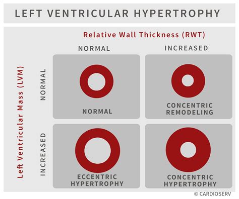 Understanding LVH Part 2: How to Mea